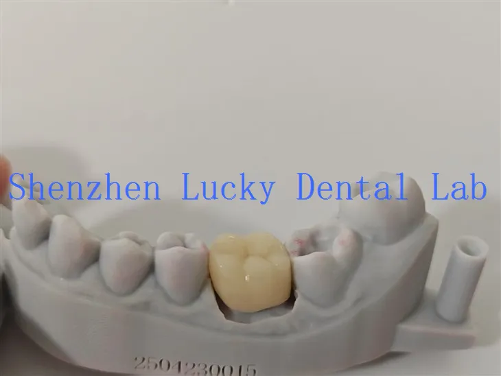 Natuurlijke 3D -print Emax Dental Crown gemaakt in China